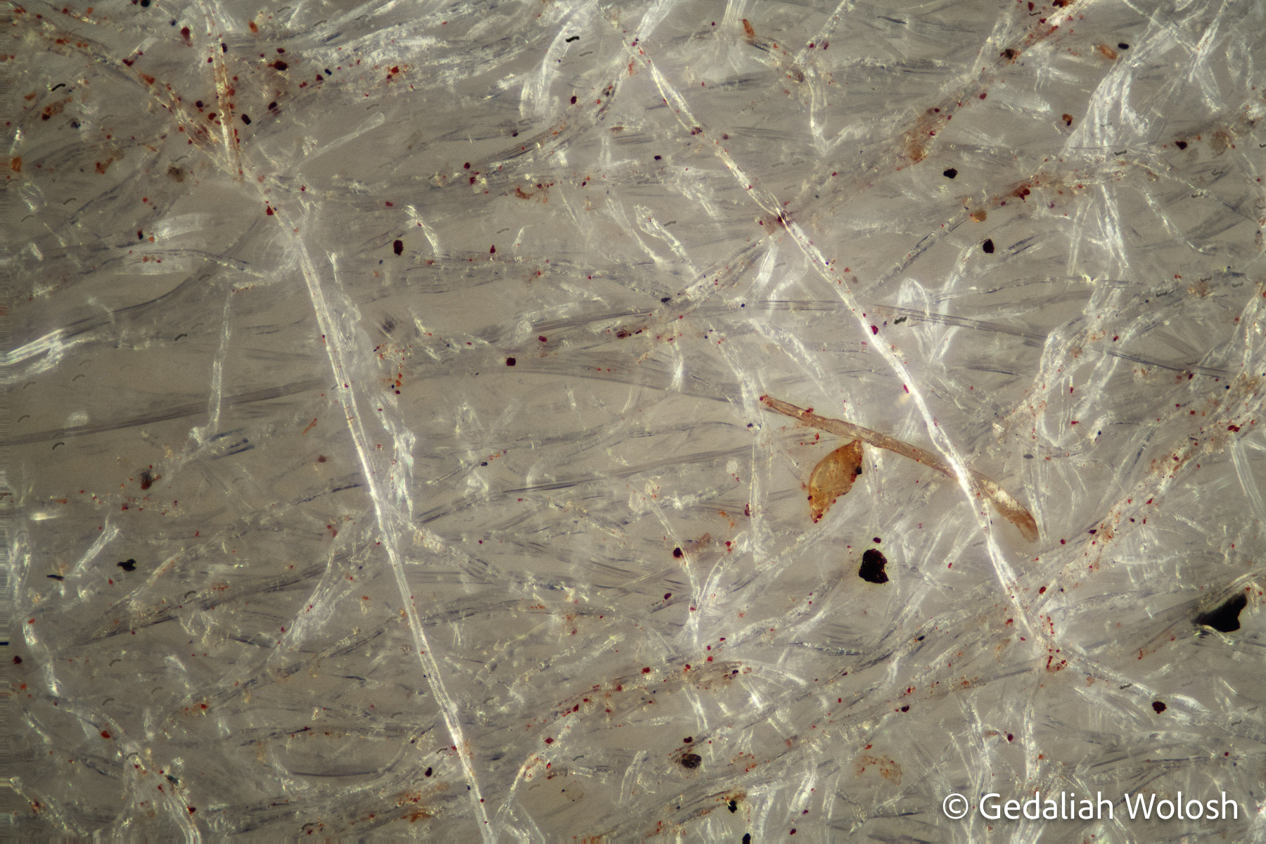 Cotton Swab A close-up look at the fibrous structure of a cotton swab, revealing entangled strands and small embedded particles. Captured...